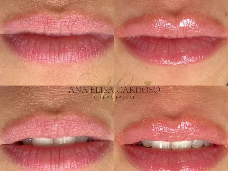 Hidra Gloss - Imagem 1